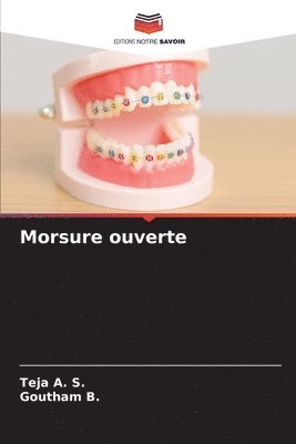 Teja A S, Goutham B, Teja A. S., Goutham B. - Morsure ouverte, Häftad