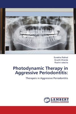 Photodynamic Therapy in Aggressive Periodontitis