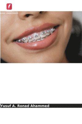 Avanços nos materiais ortodônticos