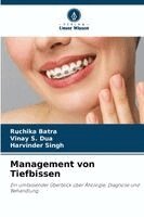 Ruchika Batra, Vinay S Dua, Harvinder Singh - Management von Tiefbissen, Häftad