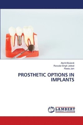 PROSTHETIC OPTIONS IN IMPLANTS