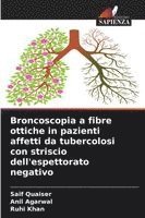 Saif Quaiser, Anil Agarwal, Ruhi Khan - Broncoscopia a fibre ottiche in pazienti affetti da tubercolosi con striscio dell'espettorato negativo, Häftad