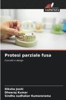 Protesi parziale fusa