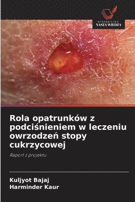 Rola opatrunków z podciśnieniem w leczeniu owrzodzeń stopy cukrzycowej