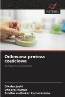 Odlewana proteza częściowa