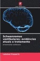 Schwannomas vestibulares