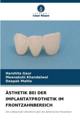 Harshita Gaur, Meenakshi Khandelwal, Deepak Mahla - Ästhetik Bei Der Implantatprothetik Im Frontzahnbereich, Häftad