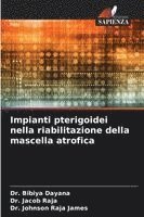 Impianti pterigoidei nella riabilitazione della mascella atrofica