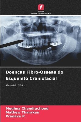Meghna Chandrachood, Mathew Tharakan, Pranave P, Pranave P. - Doenças Fibro-Osseas do Esqueleto Craniofacial, Häftad
