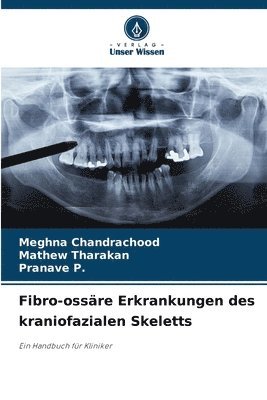 Meghna Chandrachood, Mathew Tharakan, Pranave P, Pranave P. - Fibro-ossäre Erkrankungen des kraniofazialen Skeletts, Häftad