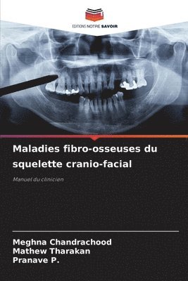 Meghna Chandrachood, Mathew Tharakan, Pranave P, Pranave P. - Maladies fibro-osseuses du squelette cranio-facial, Häftad