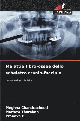 Meghna Chandrachood, Mathew Tharakan, Pranave P, Pranave P. - Malattie fibro-ossee dello scheletro cranio-facciale, Häftad
