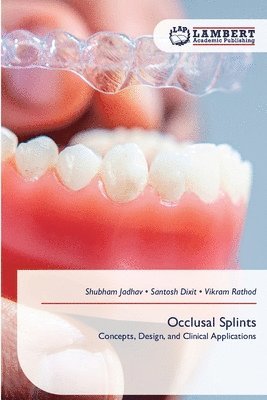 Occlusal Splints