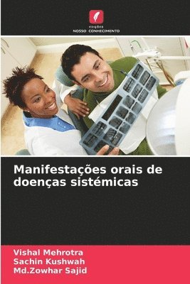 Manifestações orais de doenças sistémicas