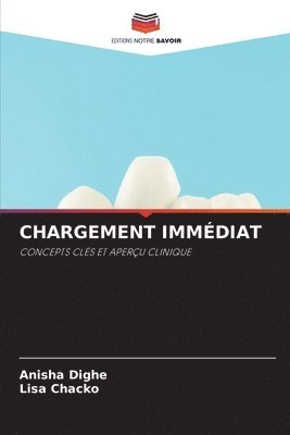 Chargement Immédiat