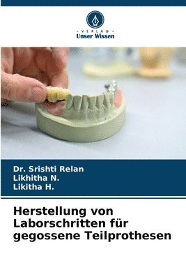 Herstellung von Laborschritten für gegossene Teilprothesen