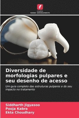 Diversidade de morfologias pulpares e seu desenho de acesso