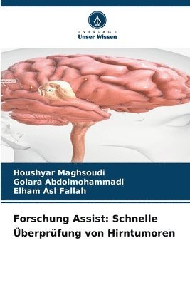 Forschung Assist: Schnelle Überprüfung von Hirntumoren