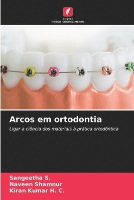 Sangeetha S., Naveen Shamnur, Kiran Kumar H. C. - Arcos em ortodontia, Häftad