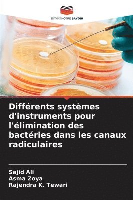 Différents systèmes d'instruments pour l'élimination des bactéries dans les canaux radiculaires