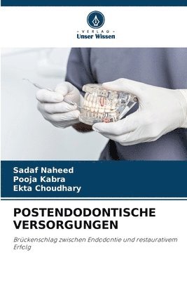 Postendodontische Versorgungen