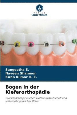 Sangeetha S., Naveen Shamnur, Kiran Kumar H. C. - Bögen in der Kieferorthopädie, Häftad