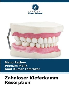 Manu Rathee, Poonam Malik, Amit Kumar Tamrakar - Zahnloser Kieferkamm Resorption, Häftad