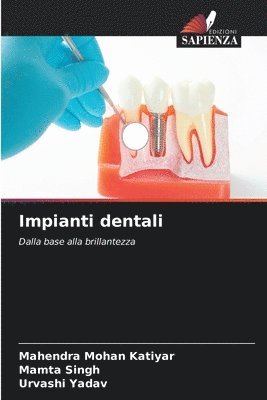 Impianti dentali