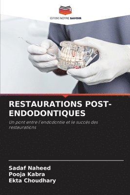 Restaurations Post-Endodontiques