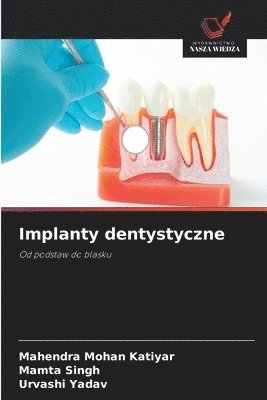Implanty dentystyczne