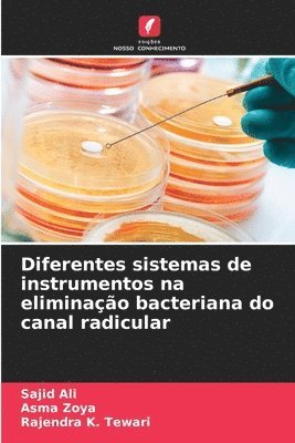 Diferentes sistemas de instrumentos na eliminação bacteriana do canal radicular