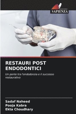 Restauri Post Endodontici