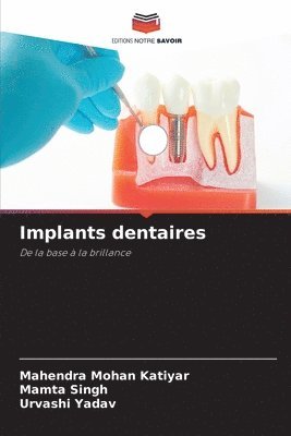 Implants dentaires