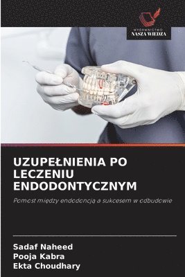 Uzupelnienia Po Leczeniu Endodontycznym