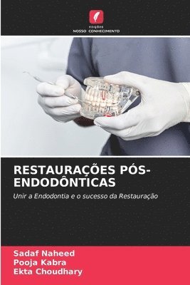 Restaurações Pós-Endodônticas