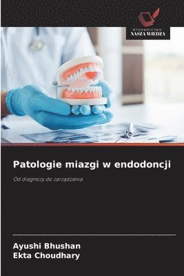 Patologie miazgi w endodoncji