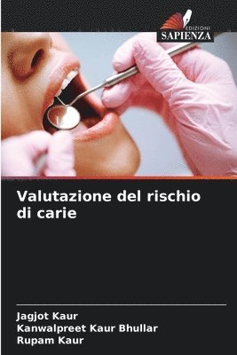 Valutazione del rischio di carie
