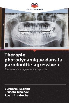 Thérapie photodynamique dans la parodontite agressive