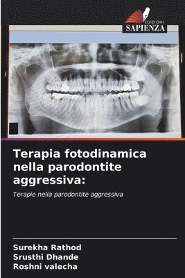Terapia fotodinamica nella parodontite aggressiva