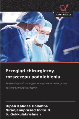 Przegląd chirurgiczny rozszczepu podniebienia