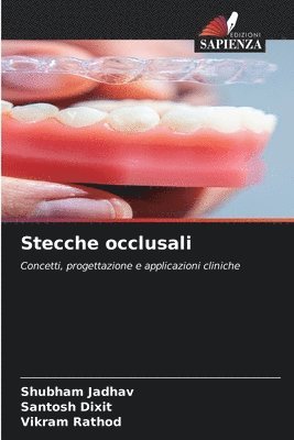 Stecche occlusali