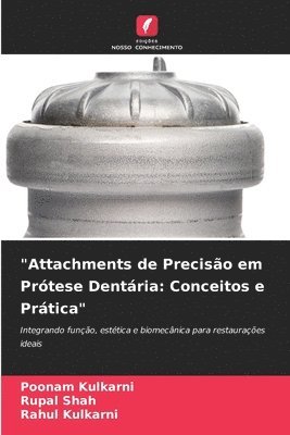 "Attachments de Precisão em Prótese Dentária: Conceitos e Prática"