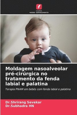 Moldagem nasoalveolar pré-cirúrgica no tratamento da fenda labial e palatina