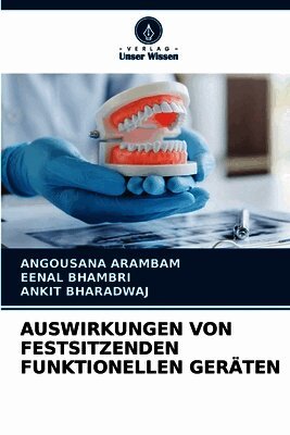 AUSWIRKUNGEN VON FESTSITZENDEN FUNKTIONELLEN GERÄTEN