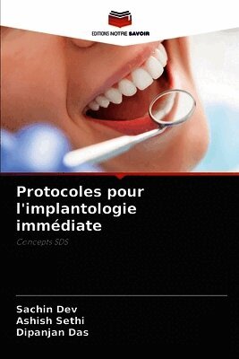 Protocoles pour l'implantologie immédiate
