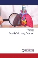 Wala Ben Kridis, Afef Khanfir - Small Cell Lung Cancer, Häftad. Tillgänglighet: Lägg i varukorg