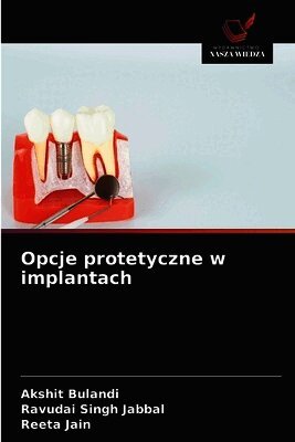 Opcje protetyczne w implantach