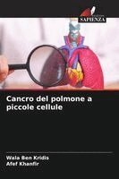 Wala Ben Kridis, Afef Khanfir - Cancro del polmone a piccole cellule, Häftad. Tillgänglighet: Lägg i varukorg