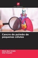 Wala Ben Kridis, Afef Khanfir - Cancro do pulmão de pequenas células, Häftad. Tillgänglighet: Lägg i varukorg