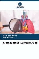 Wala Ben Kridis, Afef Khanfir - Kleinzelliger Lungenkrebs, Häftad. Tillgänglighet: Lägg i varukorg
